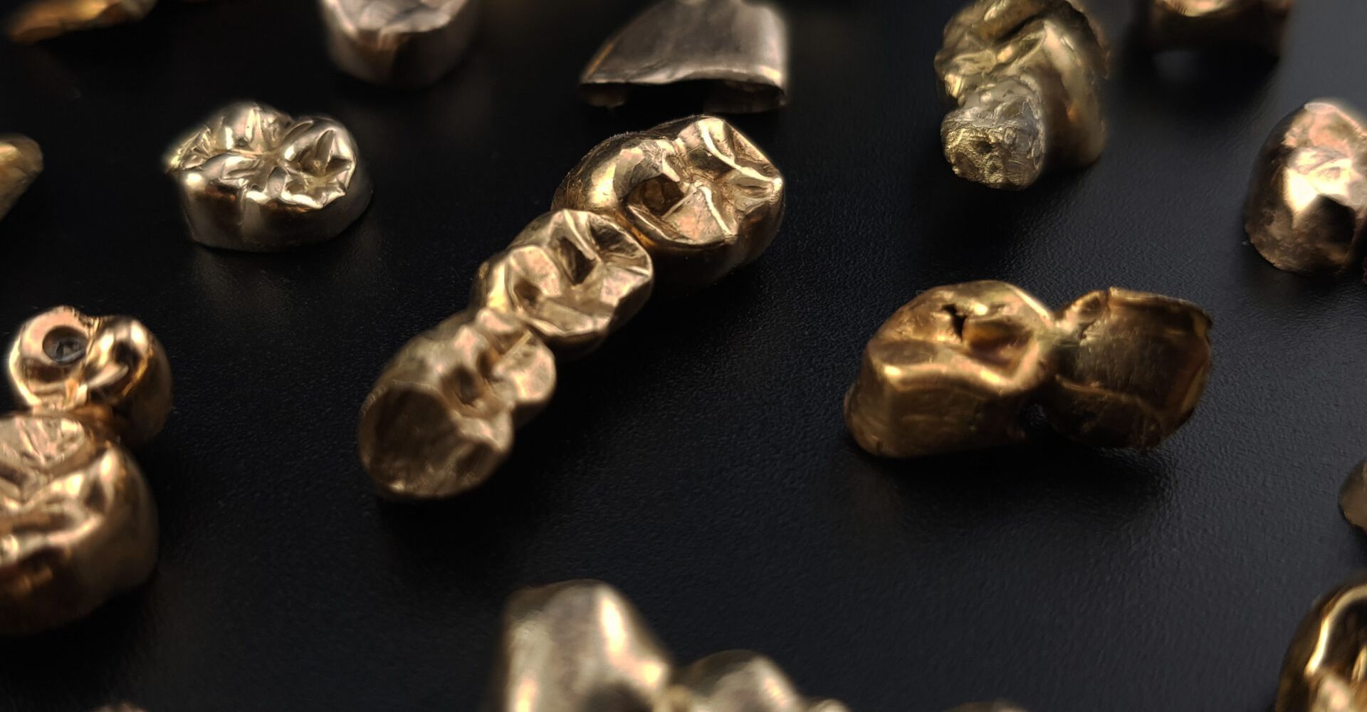 Jetzt Zahngold zuverlässig bewerten lassen, Goldzähne, Goldbrücken, Goldreste, Goldprothesen, Dentalgold